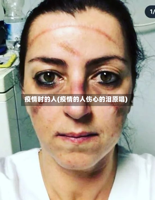 疫情时的人(疫情的人伤心的泪原唱)-第2张图片